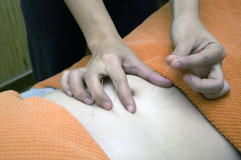 osteopathe-AURIBEAU SUR SIAGNE-min_acupuncture-4175625